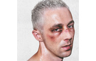 Download Foto: Ein Mann mit kurzen grauen Haaren und blauer Flecken um die Augen schaut in die Kamera vor einem weißen Hintergrund.